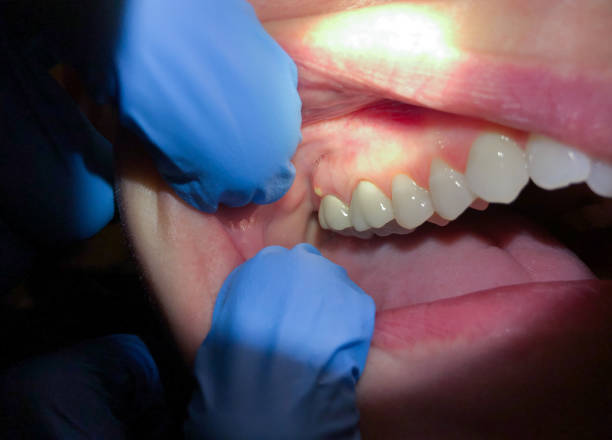  Rutgers University Livingston Campus, NJ Emergency Dentist Pros