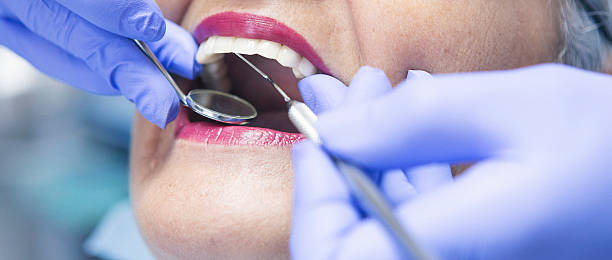 Best Emergency Dental Care for Sports Injuries in Rutgers University Livingston Campus, NJ